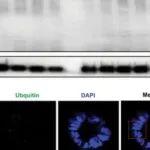 Autophagy丨西南大学张艳等研究发现Nd突变家蚕可作为研究蛋白质聚集疾病的动物模型