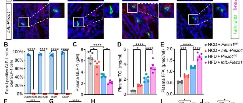 Sci Adv丨暨南大学许戈阳研究探讨了调控L细胞中Piezo1对肝脏脂质代谢的影响