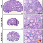 Adv Sci | 山东大学苏友强教授团队在卵子发生与卵泡发育研究领域取得新进展