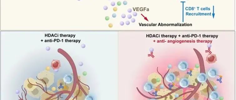 Cancer Discovery | 中山大学徐瑞华/王峰团队发现三联CAP新方案破译实体瘤免疫微环境重塑难题