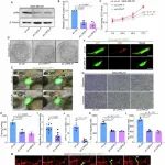 EMM丨广东医科大学张晶晶/宁国柱研究发现Reelin-LRP8信号介导乳腺癌细胞通过腔内迁移向脑内扩散