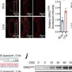 Adv Sci丨南京医科大学陈绍良/张俊霞研究发现GRK2S29p可能是治疗动脉粥样硬化的潜在治疗靶点