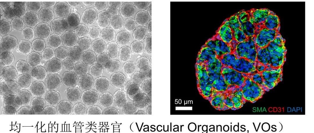 Cell Stem Cell | 北京大学王凯团队开发转录因子驱动的正向编程法快速均一地生成血管类器官用于细胞治疗