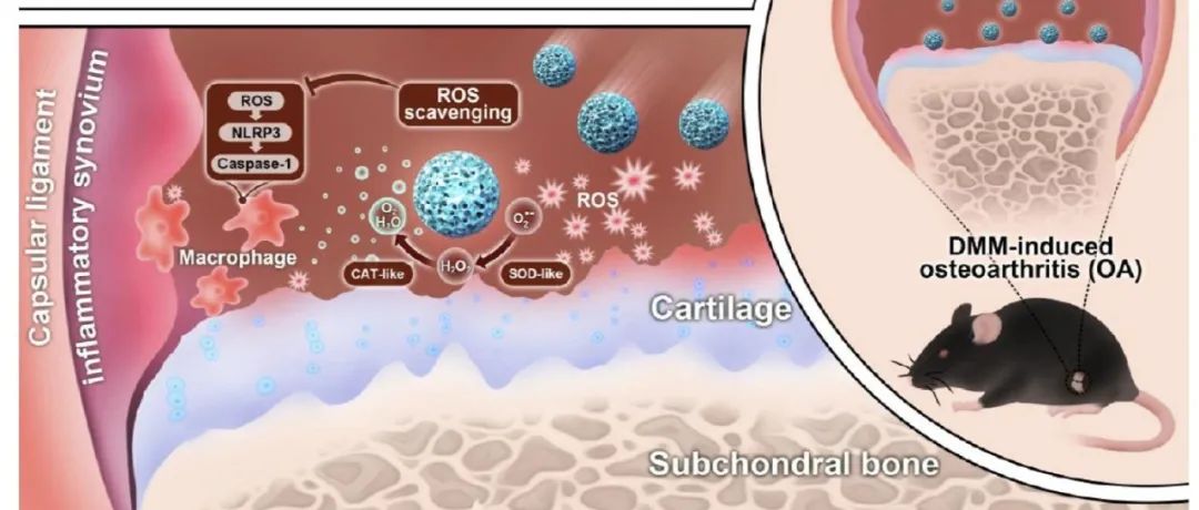 ACS Nano: d-RuO&#8322;纳米球通过抑制ROS/NLRP3/Caspase-1通路延缓骨关节炎进展