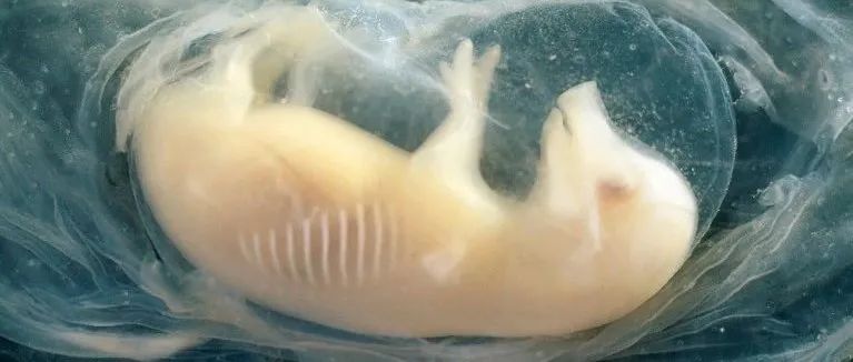 中国科学家首次在猪胚胎中培育人类心脏