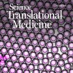 胃旁路手术为何能降低结直肠癌风险｜Science Translational Medicine