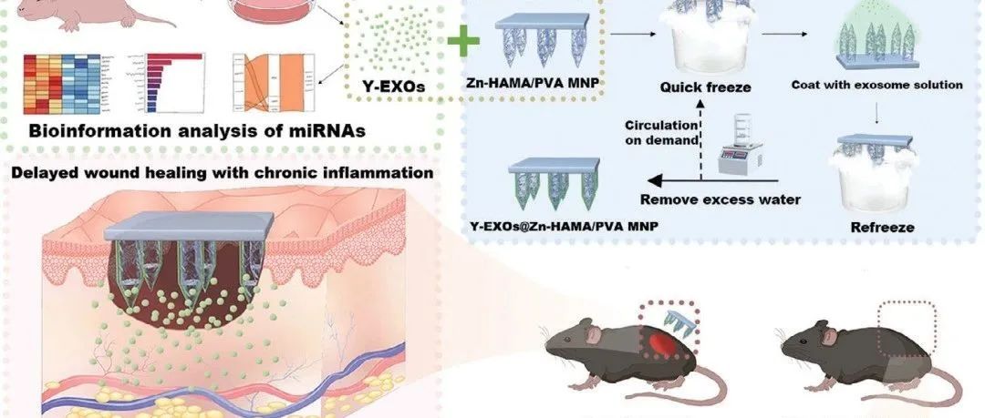 《AHM》：如何利用HAMA水凝胶微针负载外泌体促进老年伤口愈合？