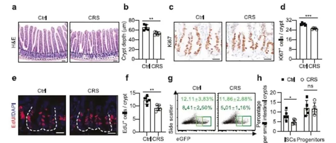 Cell Discov | 浙江大学医学院邵逸夫医院白荣盘揭示慢性压力诱导的皮质酮直接破坏肠道干细胞并加剧结肠炎