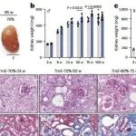 Nat Aging丨西湖大学蒋敏/张延晓合作揭秘线粒体tRNA突变在衰老过程中肾脏特异性累积规律及致病机制！