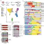Sci Transl Med | 膨胀T细胞克隆携带淋巴瘤驱动体细胞突变在难治性乳糜泻中累积