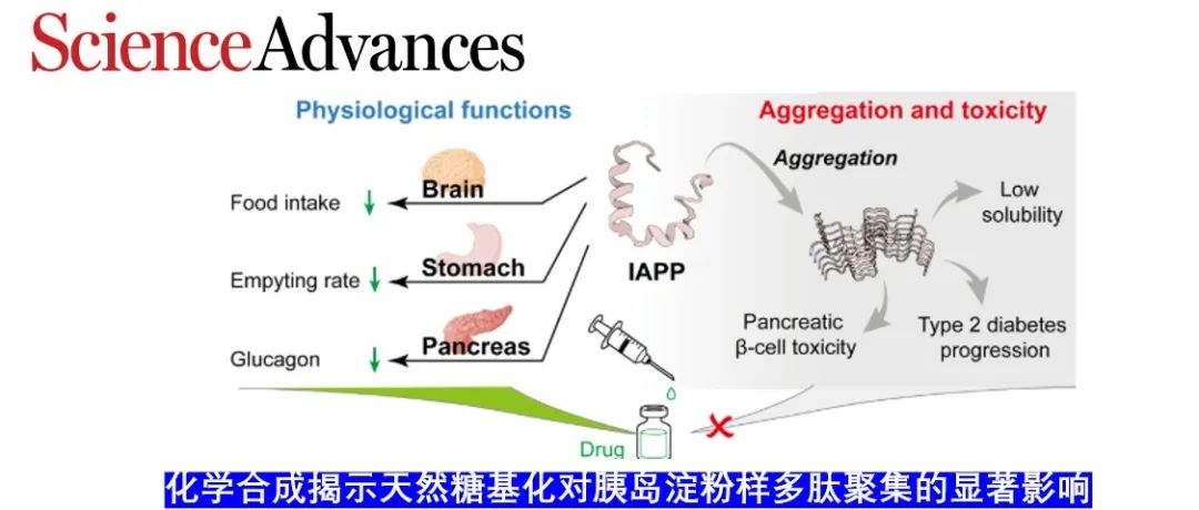 Science Advances | 化学合成揭示天然糖基化对胰岛淀粉样多肽聚集的显著影响