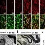 Nature Commun丨浙江大学王良等团队研究发现SEMA3B驱动轴突-轴突相互作用向轴突-胶质细胞相互作用的转变