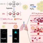 ACS Nano：微环境激活的肺栓塞长波长NIR-II可视化和协同治疗