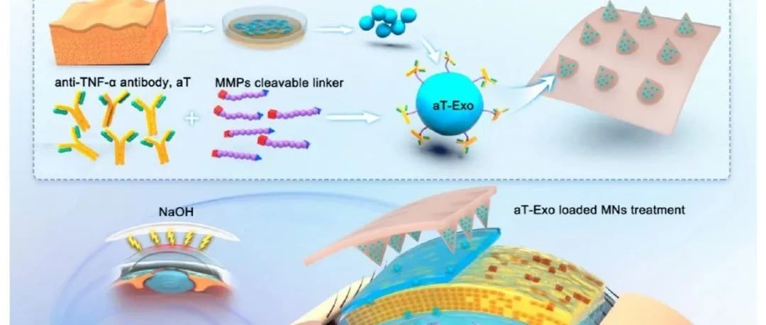 中山大学中山眼科中心《ACS Nano》：利用装载工程间充质基质细胞外泌体的微针改善化学损伤后的角膜愈合