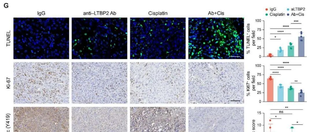 Cancer Res丨中山大学谢丹等团队研究发现LTBP2在CAF诱导肿瘤侵袭性过程中起核心作用