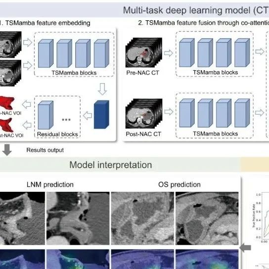 Cancer Res丨中山大学王玮等团队开发多任务深度学习模型CTSMamba以准确识别新辅助化疗后的淋巴结转移状态