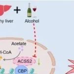 Nature Commun丨中国科学技术大学段亚君等团队研究揭示ACSS2介导的铁死亡影响ALD进展