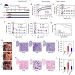 PNAS | 台湾大学林丽琼教授发现TGM2介导的谷氨酰胺脱氨基作用可增强p21在细胞衰老中的稳定性