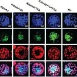 Adv Sci丨中国科学院陆发隆等团队研究发现Kdm4d/Kdm5b过表达联合TSA处理可突破表观遗传障碍