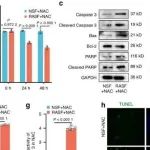 Bone Res | 江南大学袁凤来等团队发现SFs分泌特异性sEV-miRNA促进类风湿关节炎关节软骨细胞凋亡