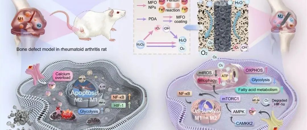 【ACS Nano】纳米酶涂层介导的巨噬细胞线粒体代谢重编程用于类风湿关节炎病例中的免疫调节性骨整合