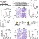 Adv Sci丨江南大学孙嘉等团队研究揭示了CLP作为哮喘治疗靶点的潜力