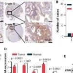 Cell Rep |&#160;华南理工大学谢克平发现Cingulin通过增强importin 7介导的磷酸化ERK核易位来促进胰腺癌