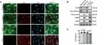 Nature Commun丨郑州大学高路等人研究揭示circATXN1通过结合ALKBH5稳定SLUG mRNA调控内皮功能