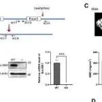Cell Rep | 北京大学韩冰等团队确定X连锁甲基转移酶SUV39H1是女性成骨的抑制因子