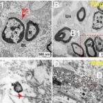 Adv Sci丨中国医学科学院徐蔚海研究发现SCs-VSMCs的相互作用可调节颅内动脉粥样硬化斑块形成