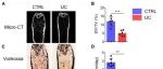 Cell Rep |&#160;浙江大学谢子昂等团队提出IBD导致骨质流失的表观遗传学机制