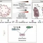 Nat Microbiol｜动物研究所刘光慧等合作揭示结核感染驱动肺衰老的机制