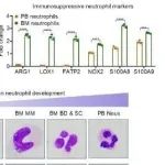 Cell Res | 南京大学李颜等团队发现人类中幼粒细胞和晚幼粒细胞阶段中性粒细胞抑制肿瘤免疫并促进癌症进展