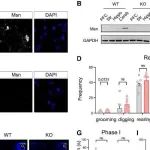 Cell Rep | 暨南大学师玲玲等团队揭示了MSN与神经行为异常之间的功能性遗传联系