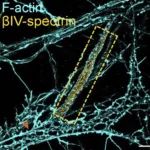 纳米尺度的单分子定位技术在突触生物学中的创新应用