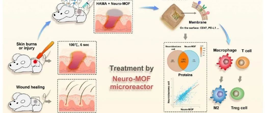 HAMA+Neuro-MOF复合水凝胶用于皮肤烧伤中的感觉恢复和毛囊新生