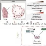 【科技前沿】NAT MICROBIOL｜刘光慧团队等揭示细胞衰老介导肺结核后遗症的分子机制，并提出潜在干预靶点
