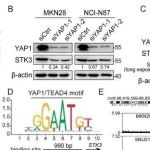 Mol Cancer丨香港中文大学康伟阐明了STK3在胃癌进展中的上调模式及其分子机制