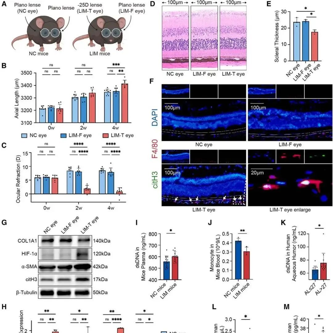 Cell Rep | 复旦大学附属中山医院戴锦晖与复旦大学基础医学院严大鹏合作通过透镜诱导近视模型揭示巨噬细胞新机制