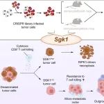 J Hepatol | 复旦大学孙云帆等团队发现肝细胞癌中SGK1缺失通过促进对T细胞介导免疫的抵抗，支持转移性定植