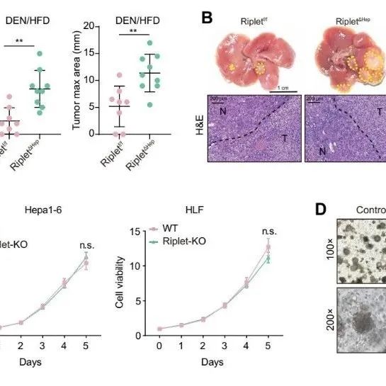 Sci&#160;Immunol | 华中科技大学张必翔等人研究发现Riplet通过STAT3依赖性CD8+T细胞耗竭促进HCC治疗耐药