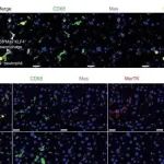 Sci&#160;Transl&#160;Med&#160;|&#160;同济大学杨长青等团队研究阐明MAS/KLF4/MERTK轴调控巨噬细胞胞葬作用的分子机制