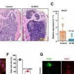 Sci Transl Med | 付蓉/刘晓智/刘志强发现MM与BMSCs的相互作用抑制骨髓瘤骨病中的纤毛发生及成骨潜能
