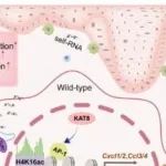 Cell Death Differ | 海军军医大学刘星光等团队揭示KAT8通过调节H4K16ac减轻银屑病皮肤障碍
