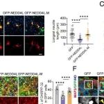 PNAS | 南京医科大学郭兴等人研究发现NEDD4L调控的LIPT2降解是一种硫辛酸代谢信号传导机制