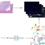 eLife&#160;|&#160;四川大学张立等团队研究发现S100a4肺泡巨噬细胞通过促进脂肪酸代谢调控的血管生成加速癌前非典型腺瘤增生进展