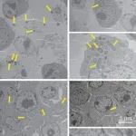Autophagy丨中国农业大学武振龙团队研究发现通过协同磷酸化TBK1介导的线粒体自噬与异源自噬可抑制胞内沙门氏菌增殖
