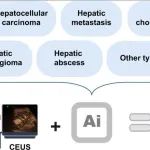 J Hepatol | 王坤/田捷/梁萍/于杰开发超声AI模型，实现肝脏病变分类诊断