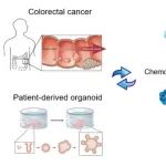Cell Research | 北京大学邓宏魁/屈默龙课题组合作通过患者来源的类器官模型揭示结直肠癌的胎样可塑性
