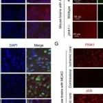 eLife | 浙江大学张纬萍等团队研究发现PINK1 泛素磷酸化增强会导致蛋白酶体损伤并促进神经退行性变